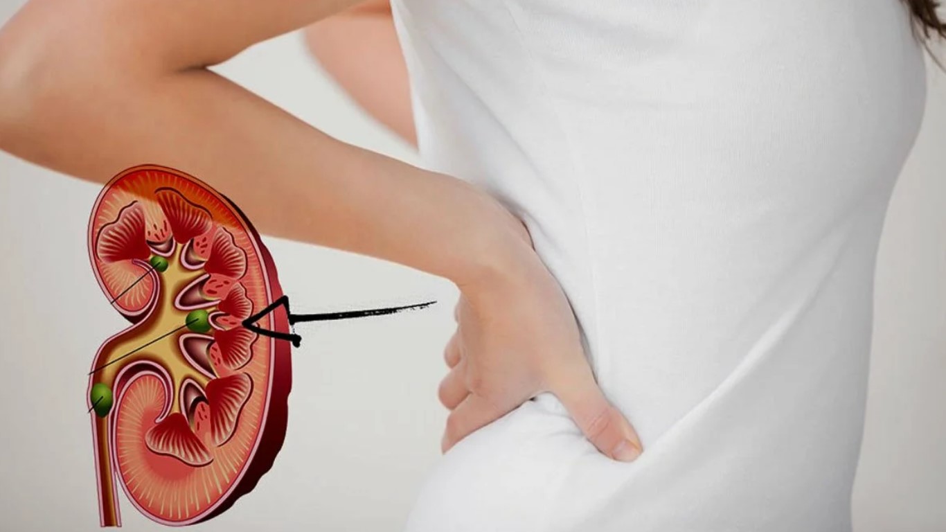 how-kidneys-hurt-pyelonephritis